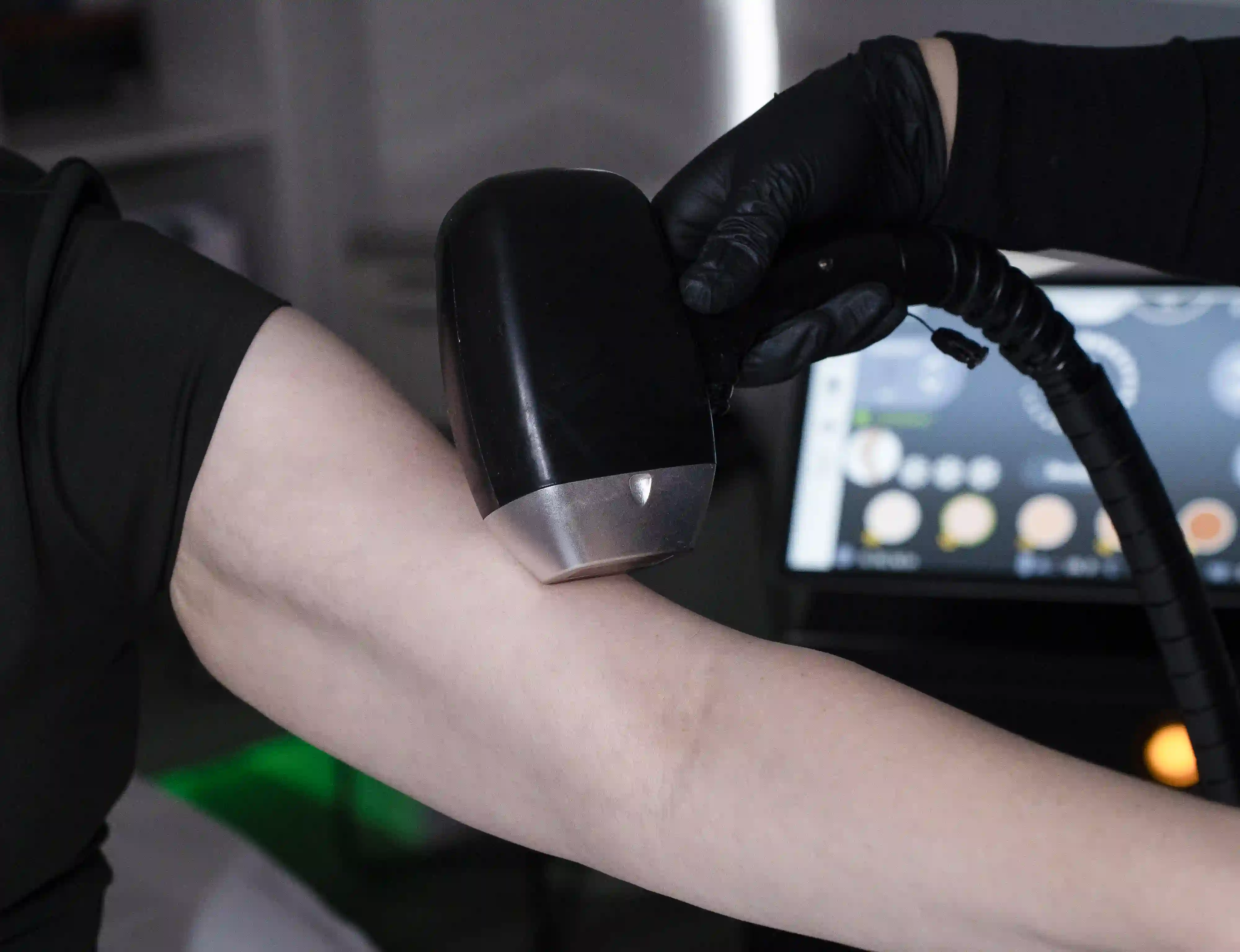 Laser Hair Removal